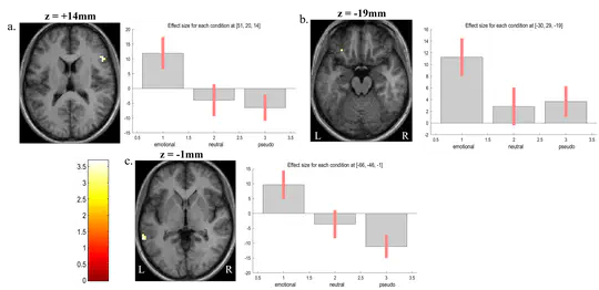 Neural correlates of visual emotional word processing - An fMRI study